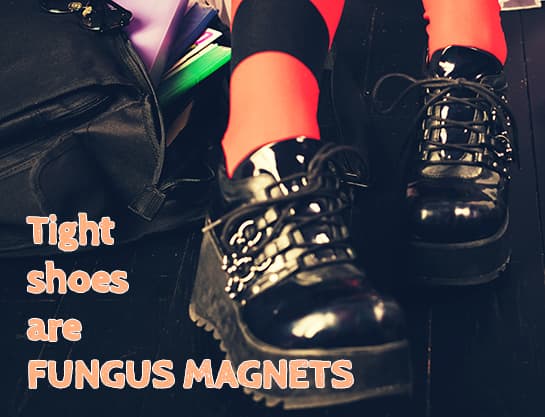 Toenail fungus and tight shoes